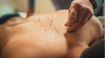 Akupunktur als natürlicher Ansatz zur Linderung von Symptomen der Menstruation